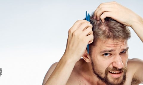 the-effects-of-hair-loss-tend-to-be-more-noticeable-in-men-than-in-women-2